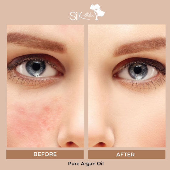Beauty Expo Deals 2026 - 30ml Pure Argan Oil